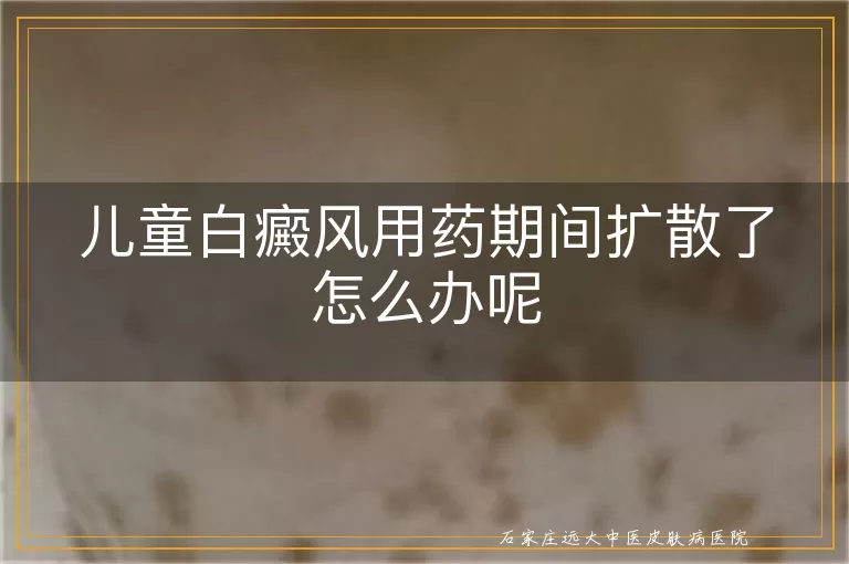 儿童白癜风用药期间扩散了怎么办呢