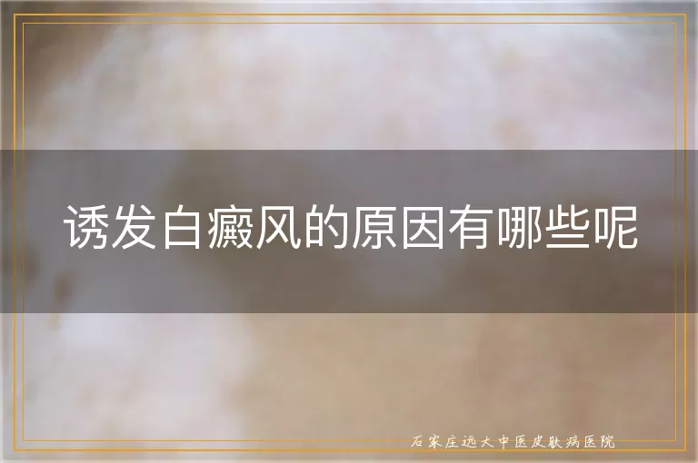 诱发白癜风的原因有哪些呢