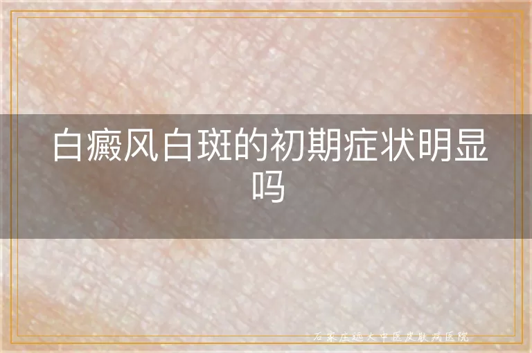 白癜风白斑的初期症状明显吗