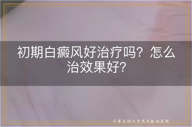 初期白癜风好治疗吗？怎么治效果好？