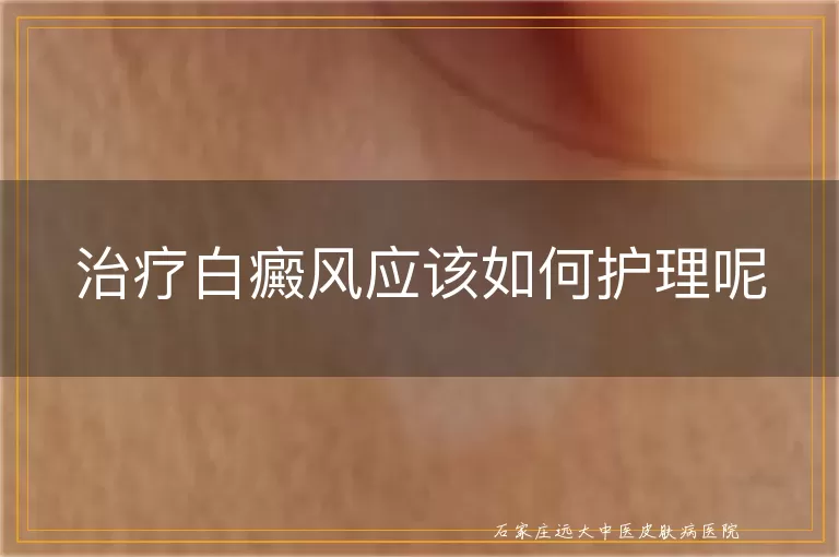 治疗白癜风应该如何护理呢