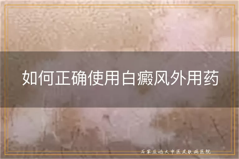 如何正确使用白癜风外用药