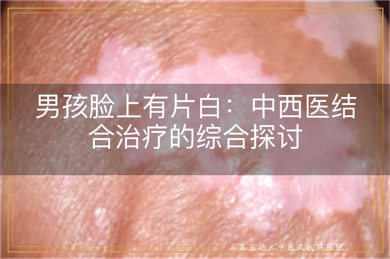 男孩脸上有片白：中西医结合治疗的综合探讨