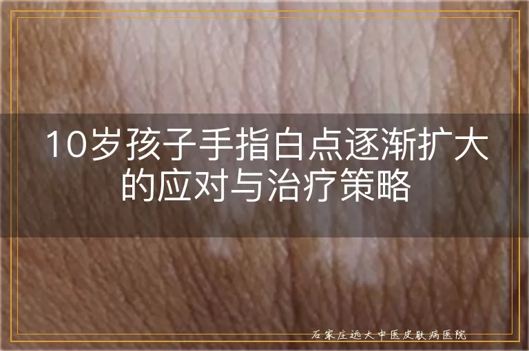 10岁孩子手指白点逐渐扩大的应对与治疗策略