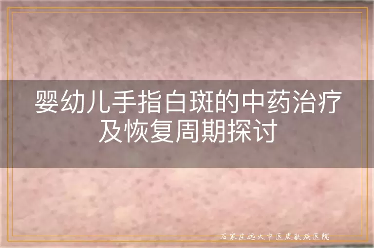 婴幼儿手指白斑的中药治疗及恢复周期探讨