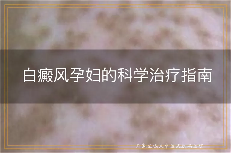 白癜风孕妇的科学治疗指南