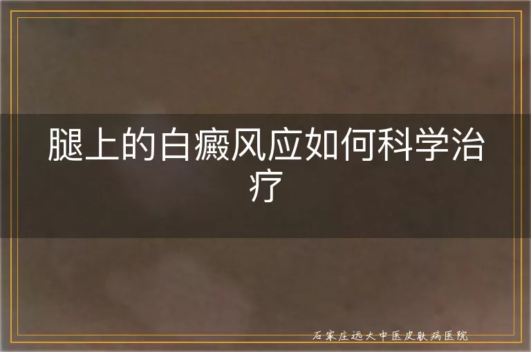 腿上的白癜风应如何科学治疗