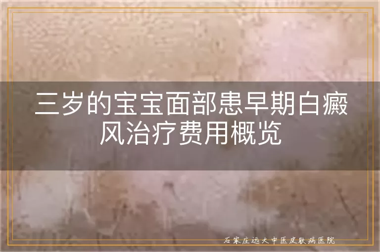 三岁的宝宝面部患早期白癜风治疗费用概览