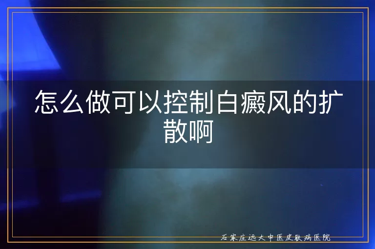 怎么做可以控制白癜风的扩散啊