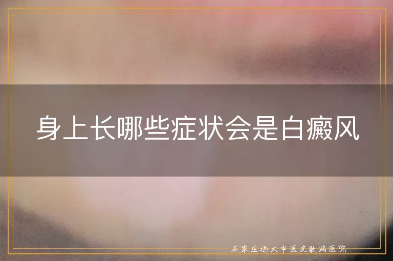 身上长哪些症状会是白癜风