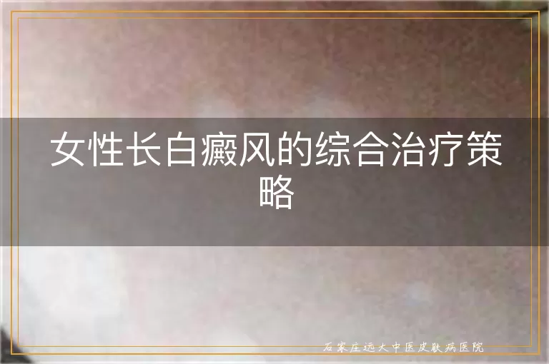 女性长白癜风的综合治疗策略