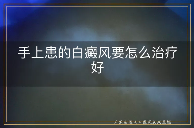 手上患的白癜风要怎么治疗好
