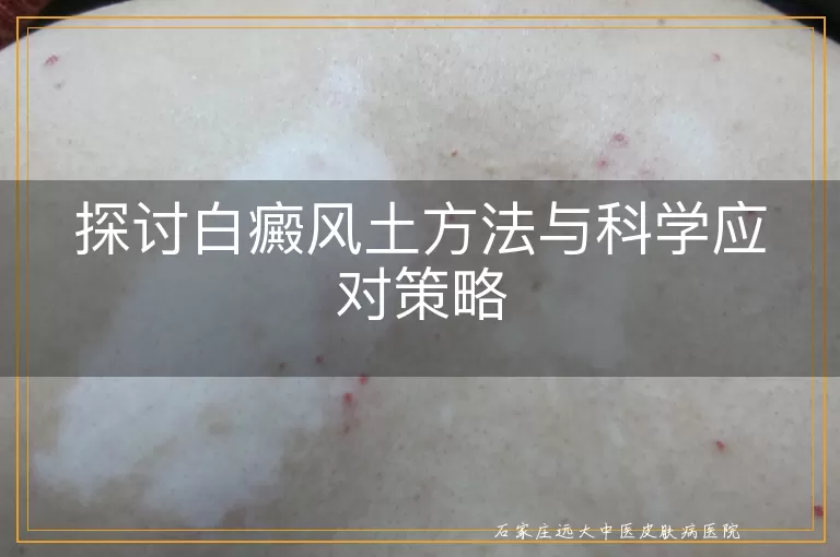 探讨白癜风土方法与科学应对策略
