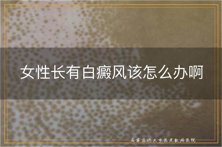 女性长有白癜风该怎么办啊