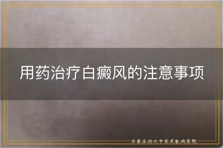用药治疗白癜风的注意事项