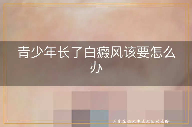 青少年长了白癜风该要怎么办