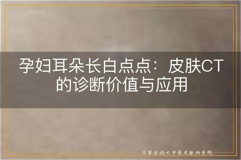 孕妇耳朵长白点点：皮肤CT的诊断价值与应用