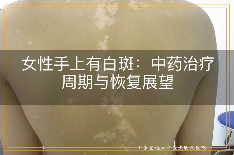 女性手上有白斑：中药治疗周期与恢复展望