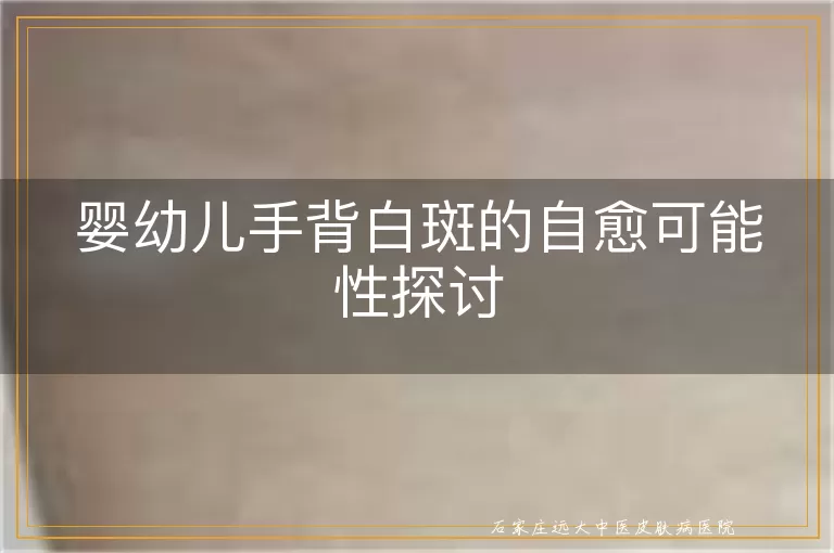 婴幼儿手背白斑的自愈可能性探讨