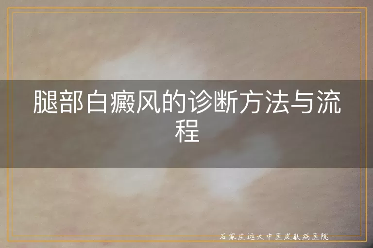 腿部白癜风的诊断方法与流程