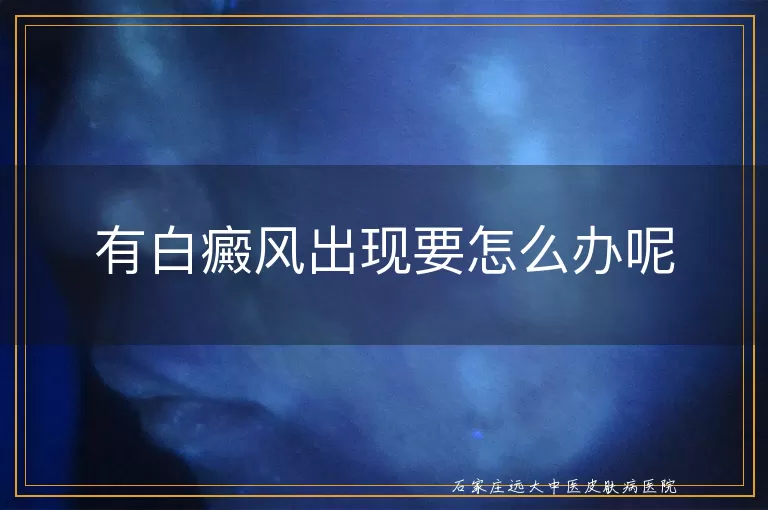 有白癜风出现要怎么办呢