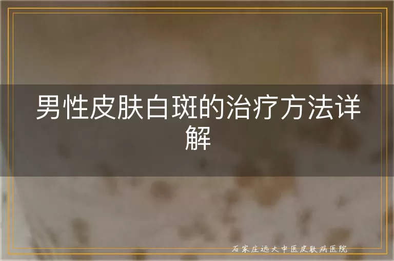 男性皮肤白斑的治疗方法详解
