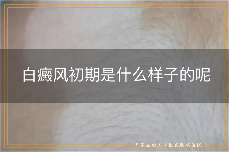 白癜风初期是什么样子的呢