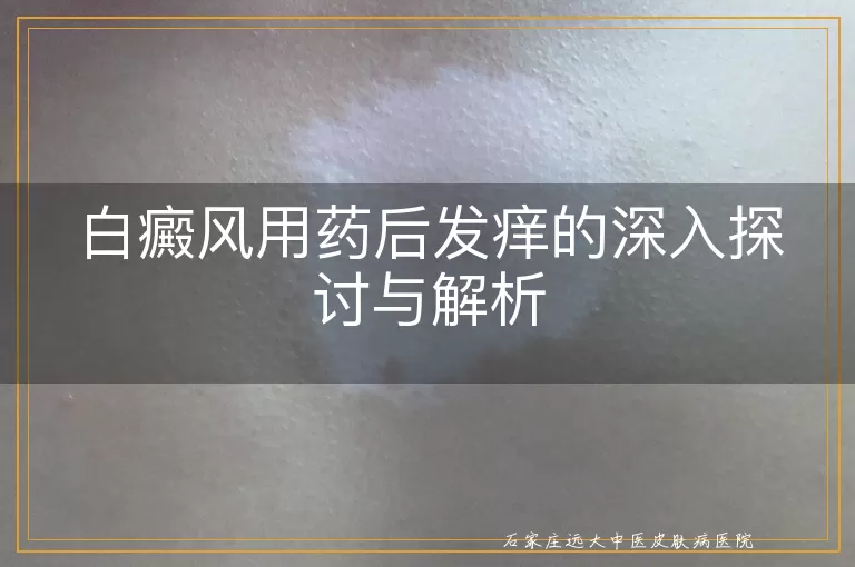 白癜风用药后发痒的深入探讨与解析
