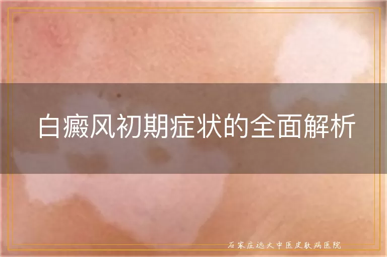 白癜风初期症状的全面解析