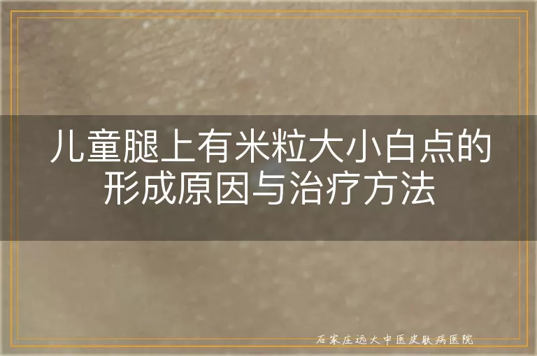 儿童腿上有米粒大小白点的形成原因与治疗方法