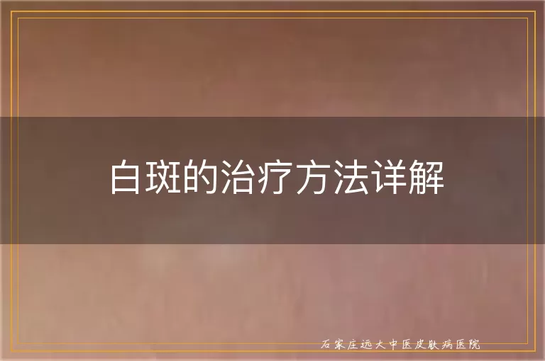 白斑的治疗方法详解