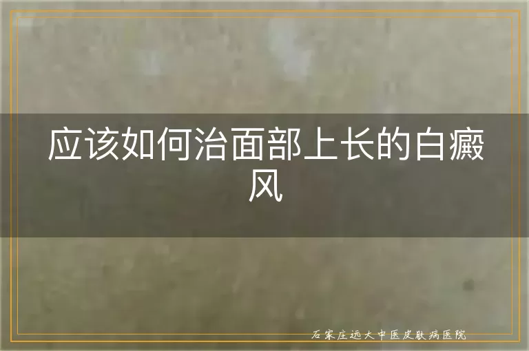 应该如何治面部上长的白癜风