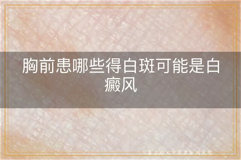 胸前患哪些得白斑可能是白癜风