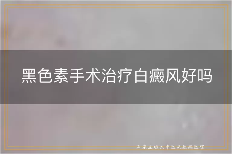 黑色素手术治疗白癜风好吗