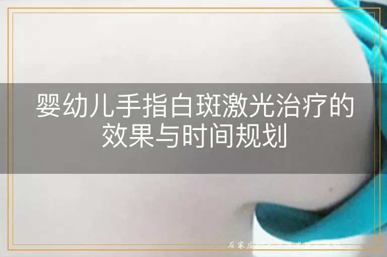 婴幼儿手指白斑激光治疗的效果与时间规划