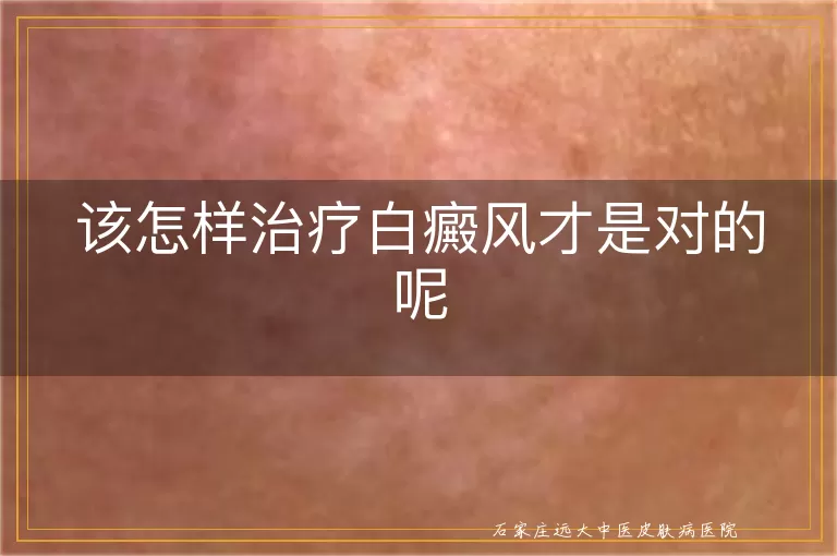 该怎样治疗白癜风才是对的呢