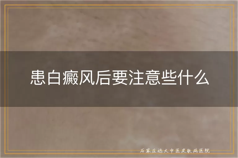 患白癜风后要注意些什么