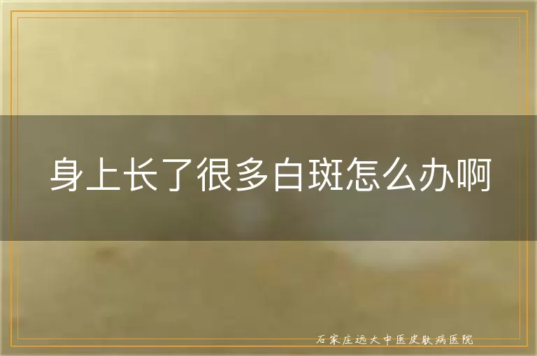 身上长了很多白斑怎么办啊