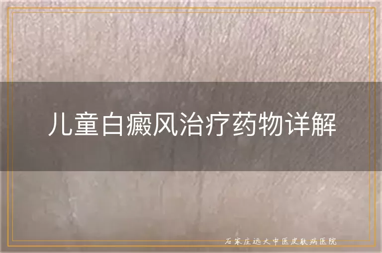 儿童白癜风治疗药物详解