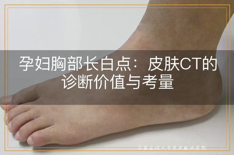 孕妇胸部长白点：皮肤CT的诊断价值与考量