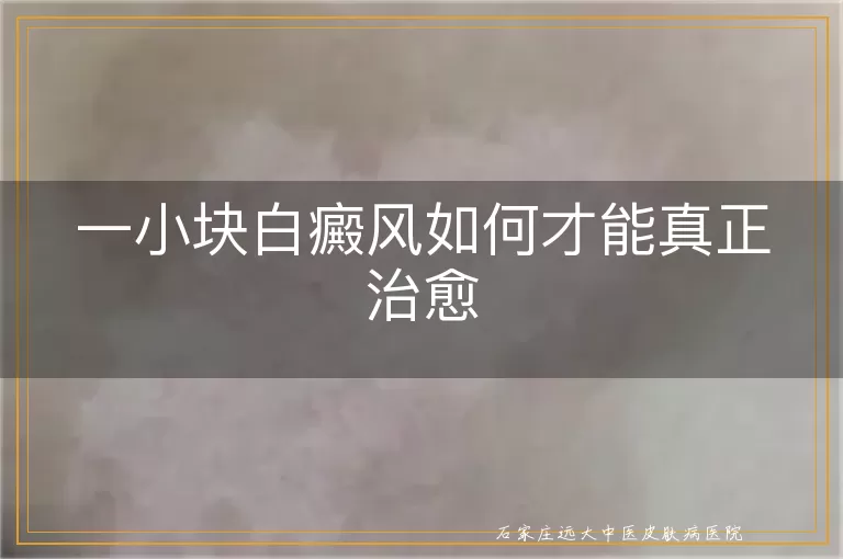 一小块白癜风如何才能真正治愈