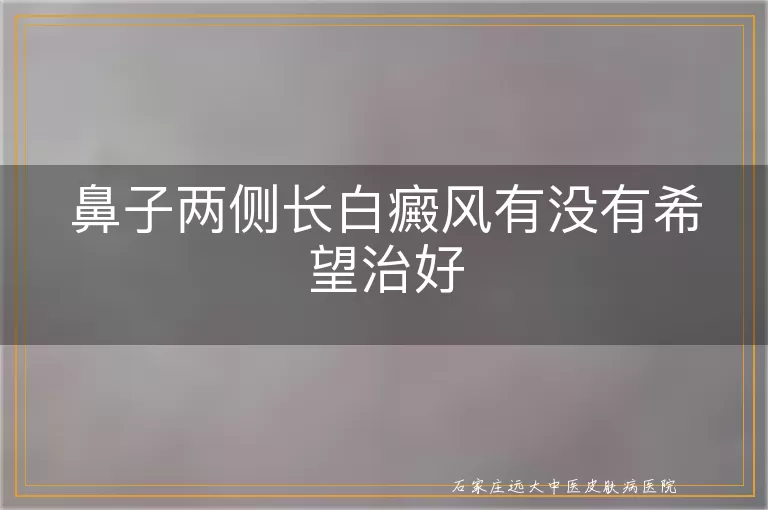 鼻子两侧长白癜风有没有希望治好