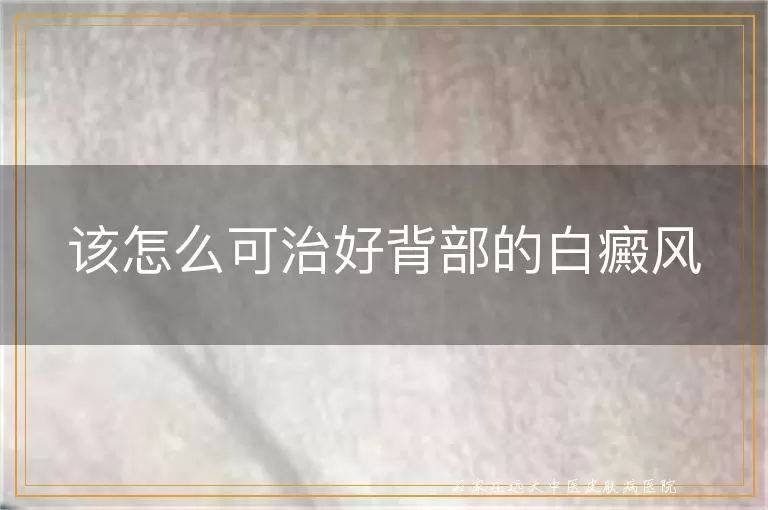 该怎么可治好背部的白癜风