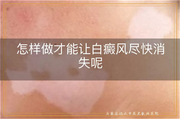 怎样做才能让白癜风尽快消失呢