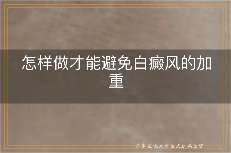 怎样做才能避免白癜风的加重