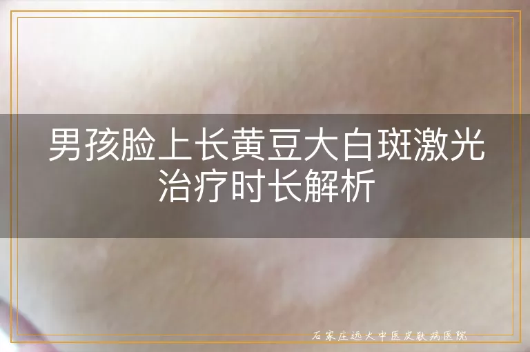 男孩脸上长黄豆大白斑激光治疗时长解析