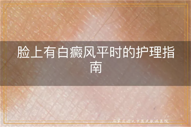 脸上有白癜风平时的护理指南