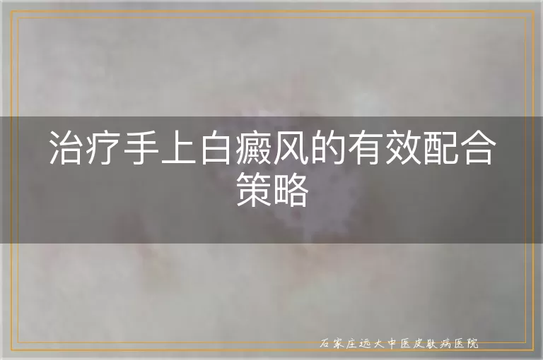 治疗手上白癜风的有效配合策略