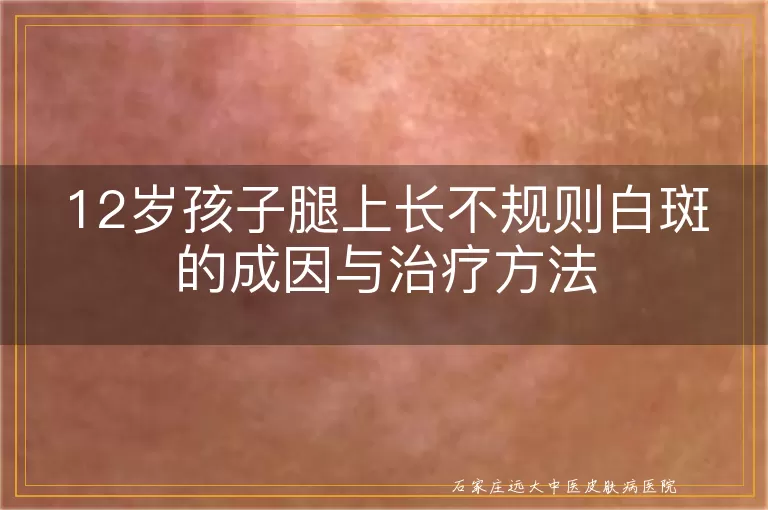 12岁孩子腿上长不规则白斑的成因与治疗方法