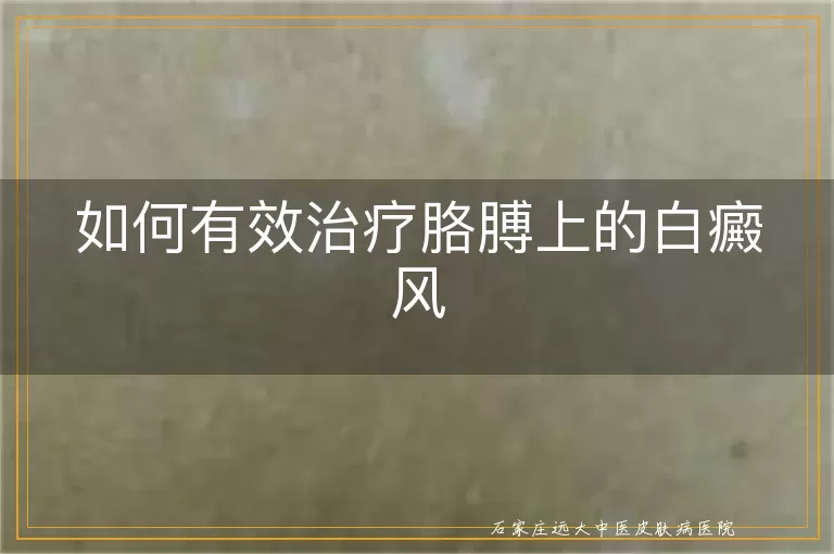 如何有效治疗胳膊上的白癜风